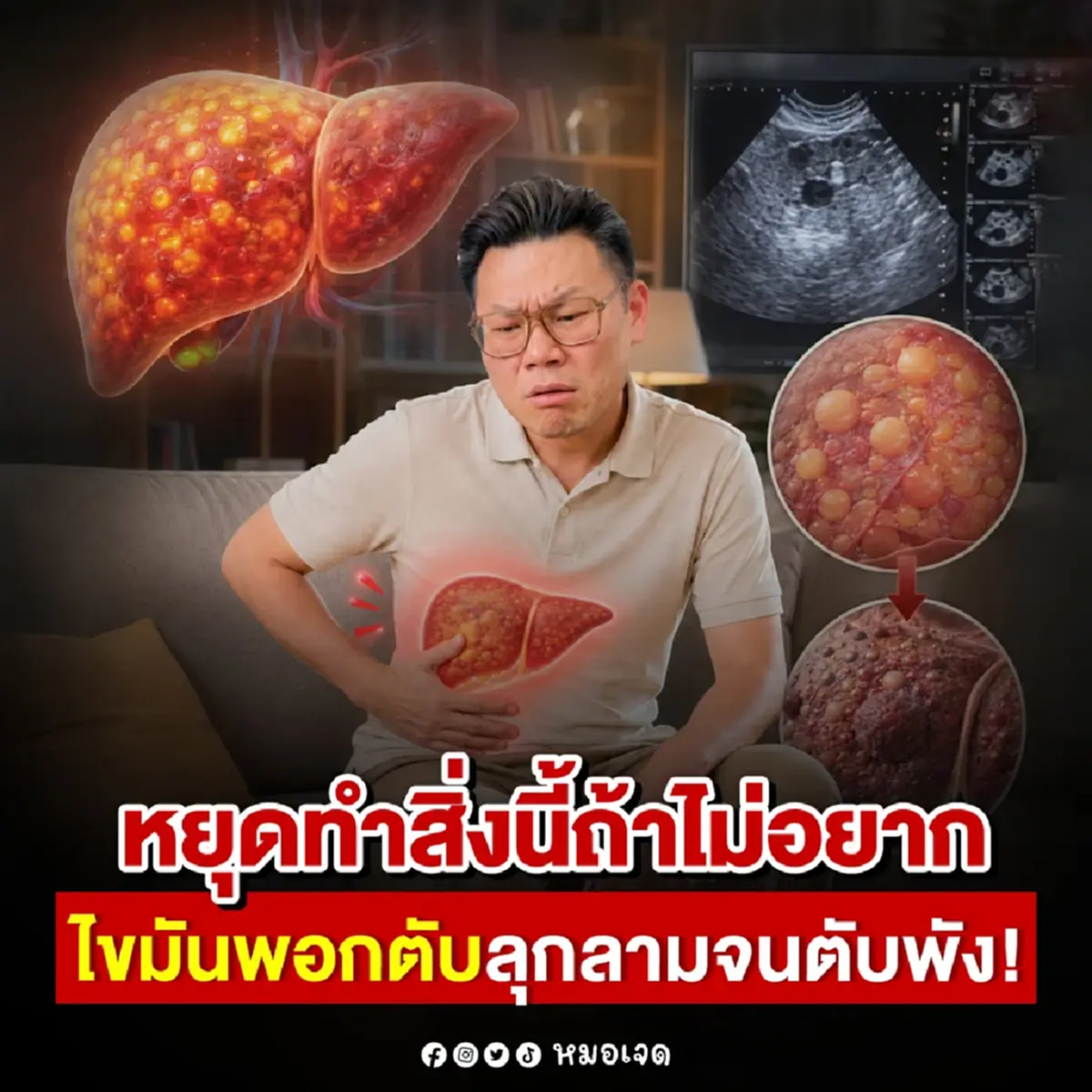 หยุดทำ 6สิ่ง ดังนี้เลย ถ้าไม่อยาก "ไขมันพอกตับ" หลายคนทำทุกวัน 