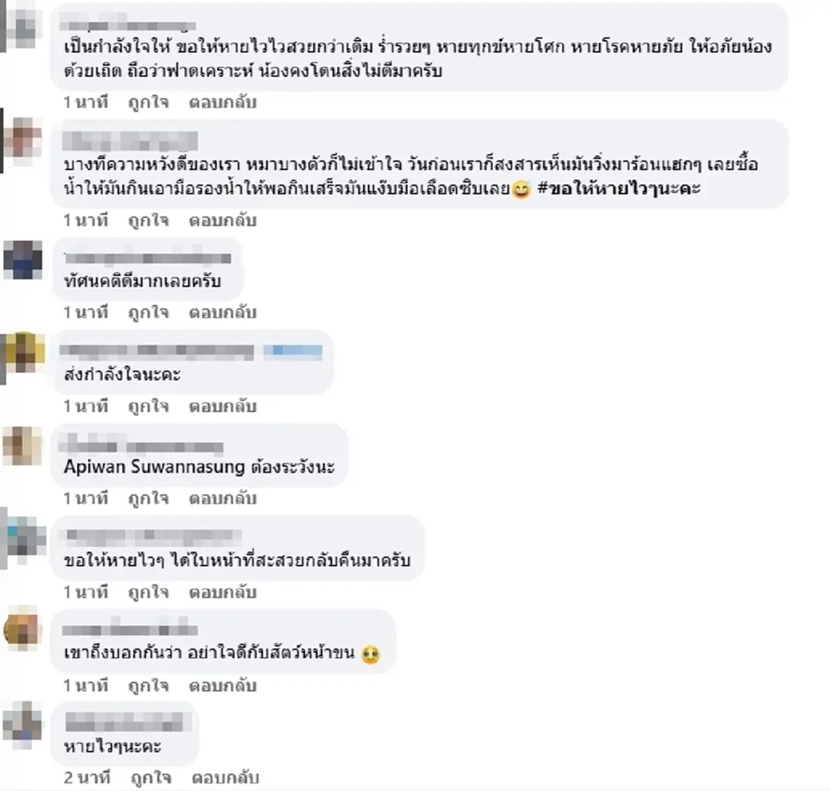 อุทาหรณ์ สาวให้อาหารหมาจร สุดท้ายโดนฝากเขี้ยวเย็บหน้า 50 เข็ม
