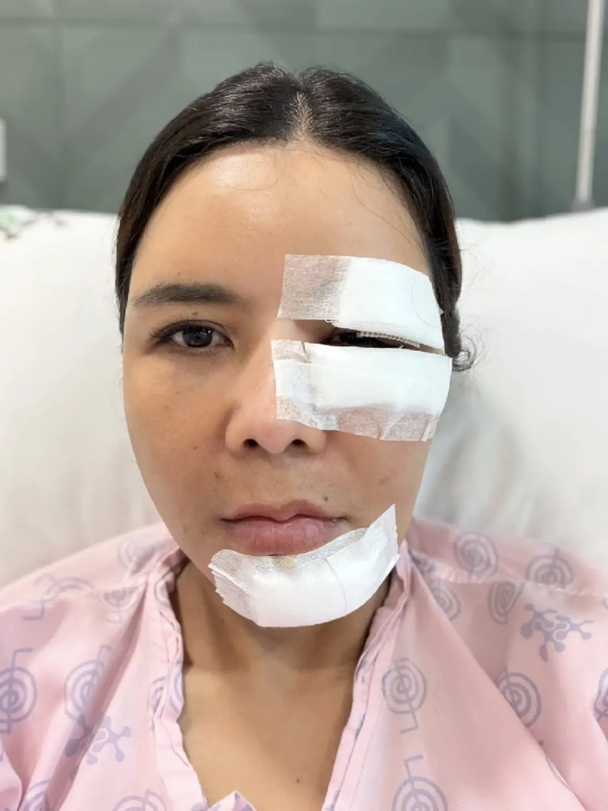 อุทาหรณ์ สาวให้อาหารหมาจร สุดท้ายโดนฝากเขี้ยวเย็บหน้า 50 เข็ม