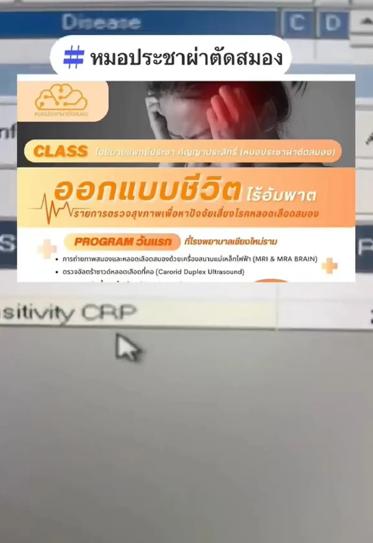 หมอดูทักระวังอัมพาต ชายวัย 69 รีบหาหมอตรวจ เจอความเสี่ยงเพียบ