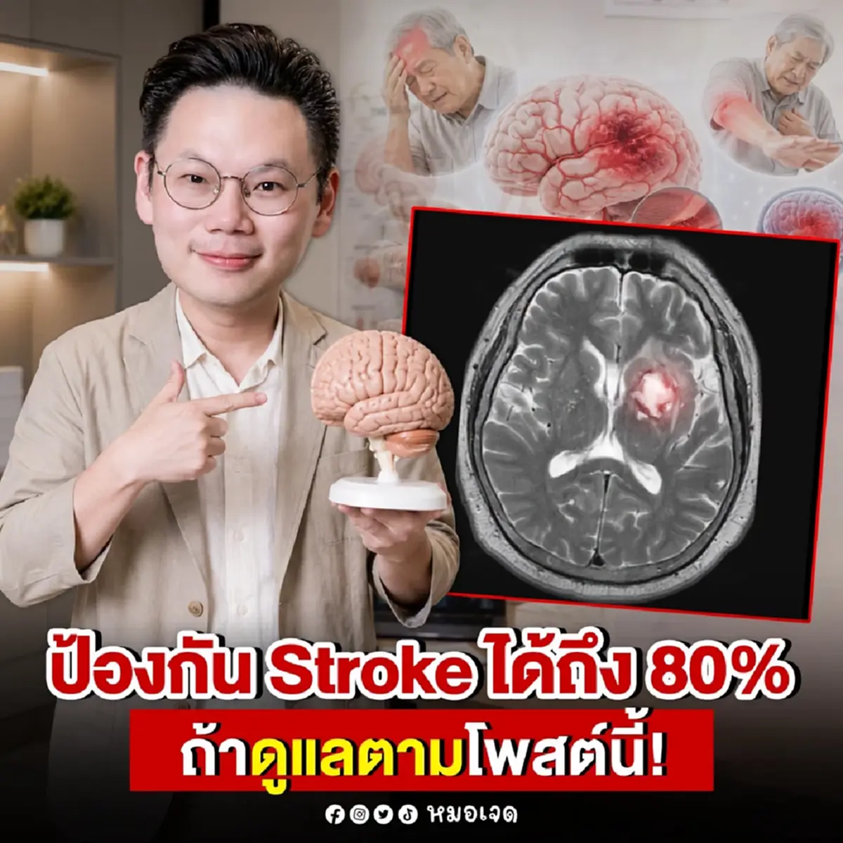 ข่าวดี "สโตรก" ป้องกันได้ถึง 80% ถ้าทำตามที่หมอบอก 8 ข้อดังนี้ 