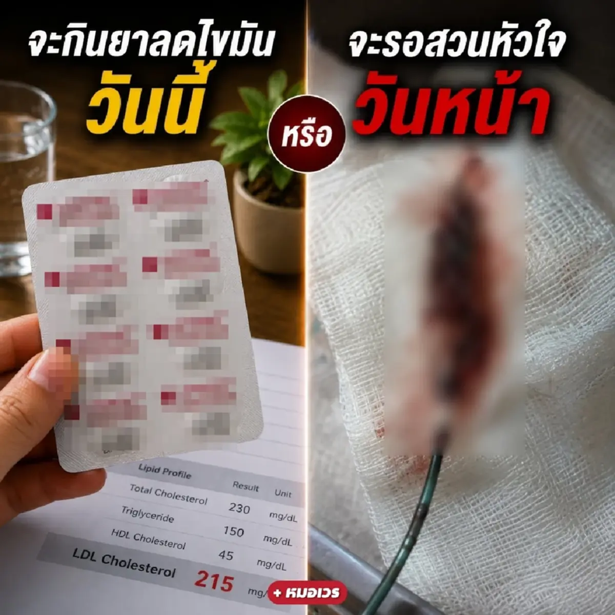 ถึงบางอ้อ หมอเผยเหตุผล ทำไมถึงต้องให้กินยาลดไขมันแต่เนิ่นๆ