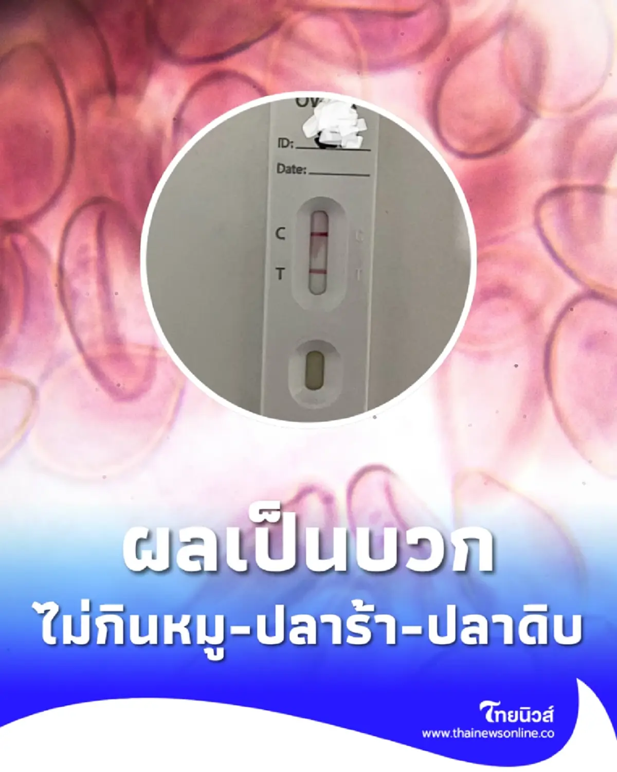 เจออีก คนอิสลาม ไม่กินเนื้อหมู ส้มตำ ปลาร้า แต่ผลตรวจเป็นบวก