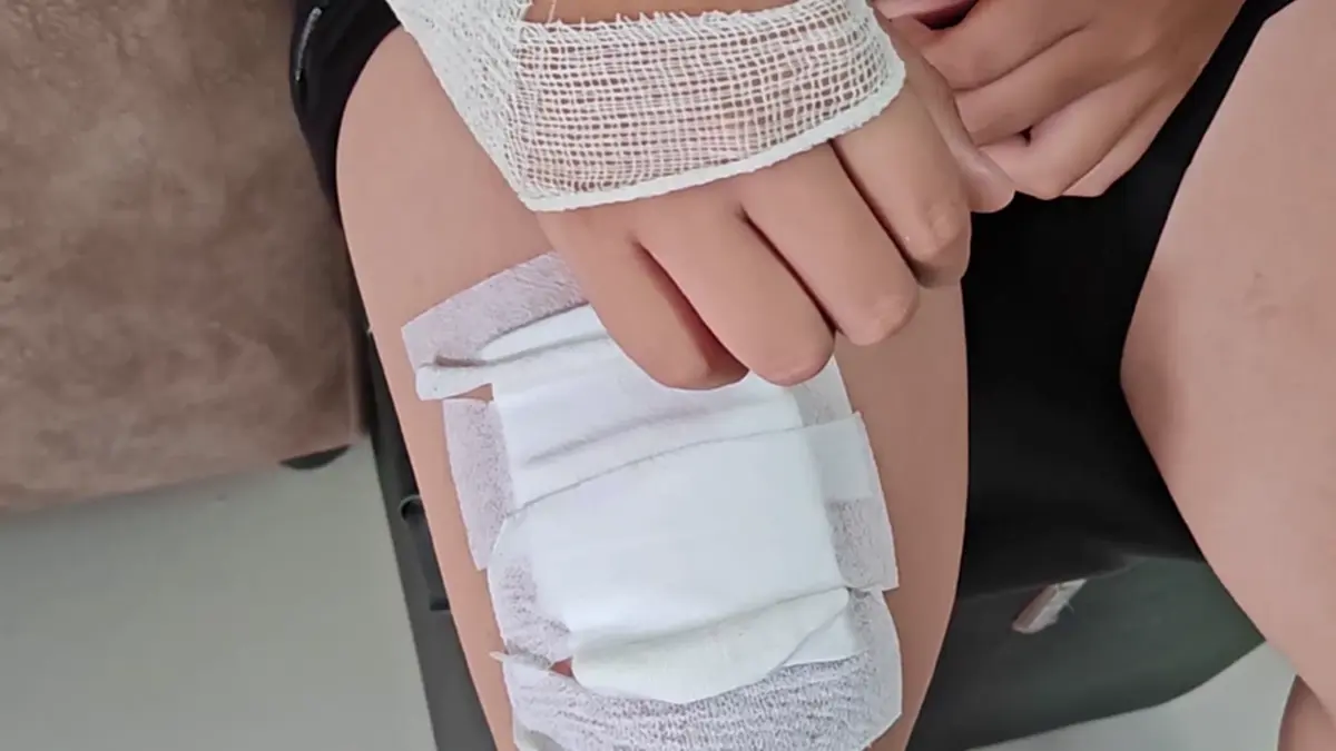 ลูกปลัดฉุนโดนจดชื่อ คว้ากรรไกรทำร้ายเพื่อนเย็บ 16 เข็ม