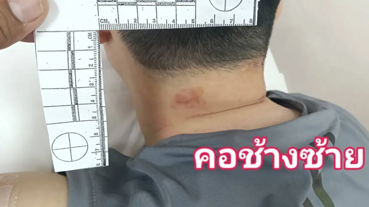อาจารย์ มน. ร้องสื่อ! ถูกปล่อยบางแก้วรุมกัดสาหัสเหตุห้ามศึก