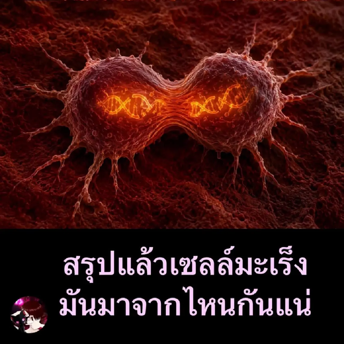 ผิดคาดหมด รู้แล้วที่แท้ "มะเร็ง" เกิดมาจากอะไร มันใกล้ตัวมาก