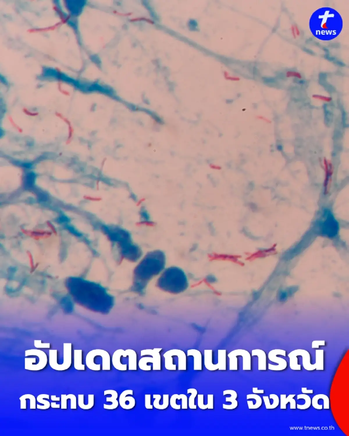 สถานการณ์ล่าสุด ยอดผู้เสียชีวิต อีโบลา ในดีอาร์คองโก ทะลุ 500 ราย