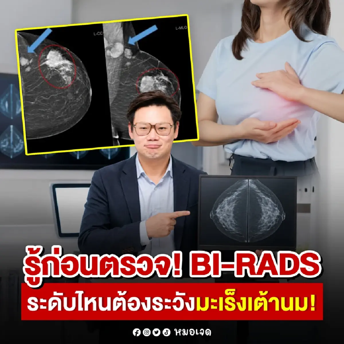 หลายคนไม่เคยรู้ "BI-RADS" ระดับไหนต้องระวัง "มะเร็งเต้านม"