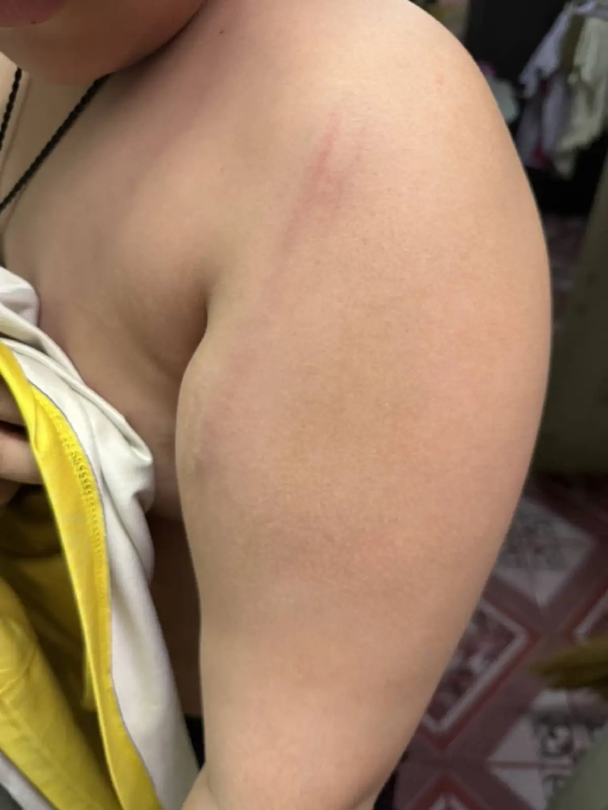 แม่แจ้งความเอาผิดครู ตีลูก ป.6 ไหล่บวมฟกช้ำ ใบรับรองแพทย์ยืนยัน