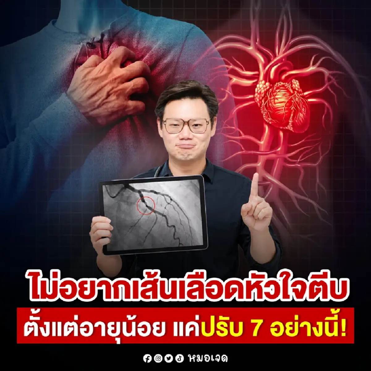 ทำเลย "7วิธี" สำคัญมาก ถ้าไม่อยาก เส้นเลือดหัวใจตีบ ตอนอายุน้อย 