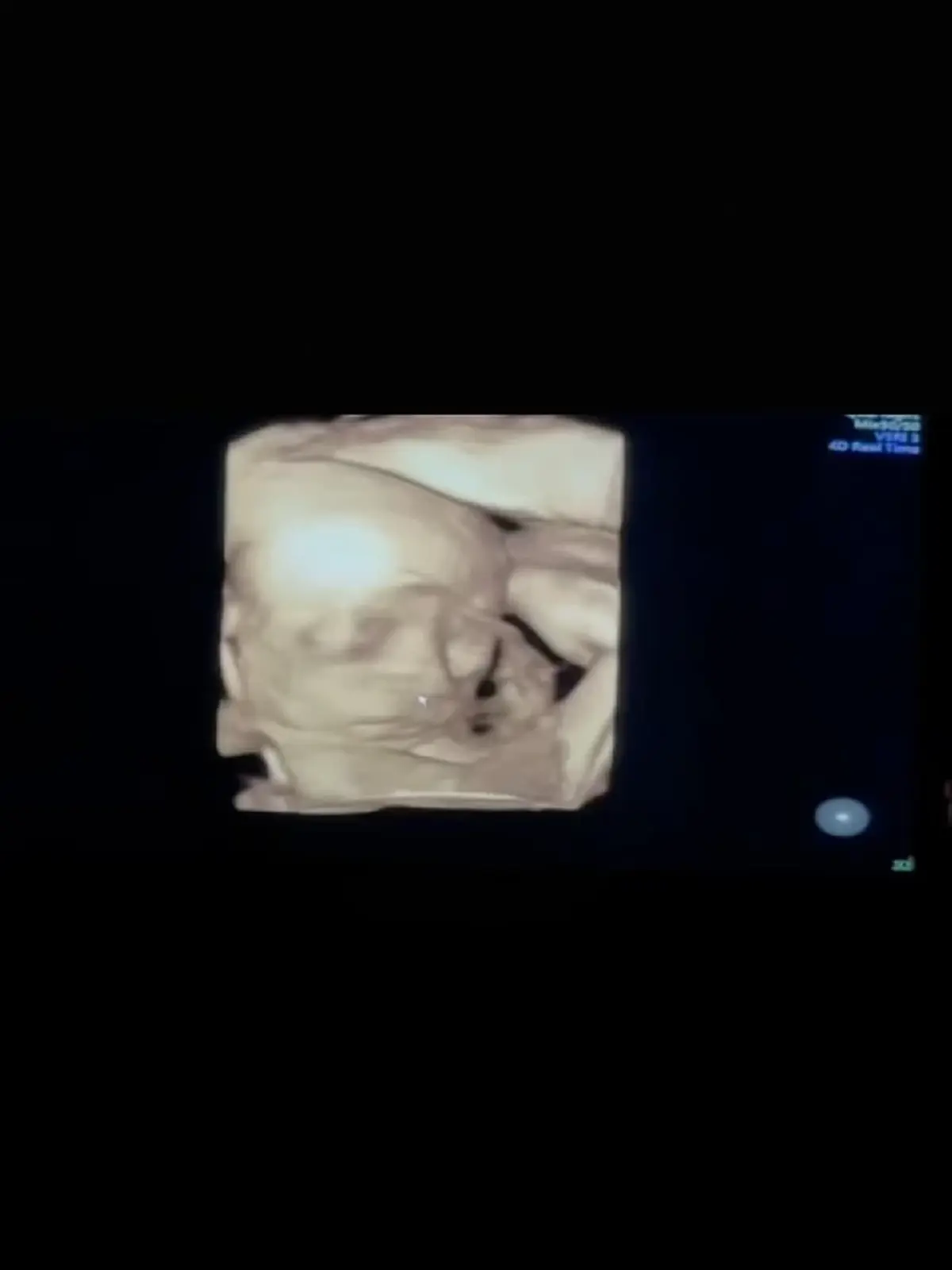 คัมแบ็กโซเชียล "มายด์ ลภัสลัล" เคลื่อนไหวล่าสุดเผยภาพลูกน้อย