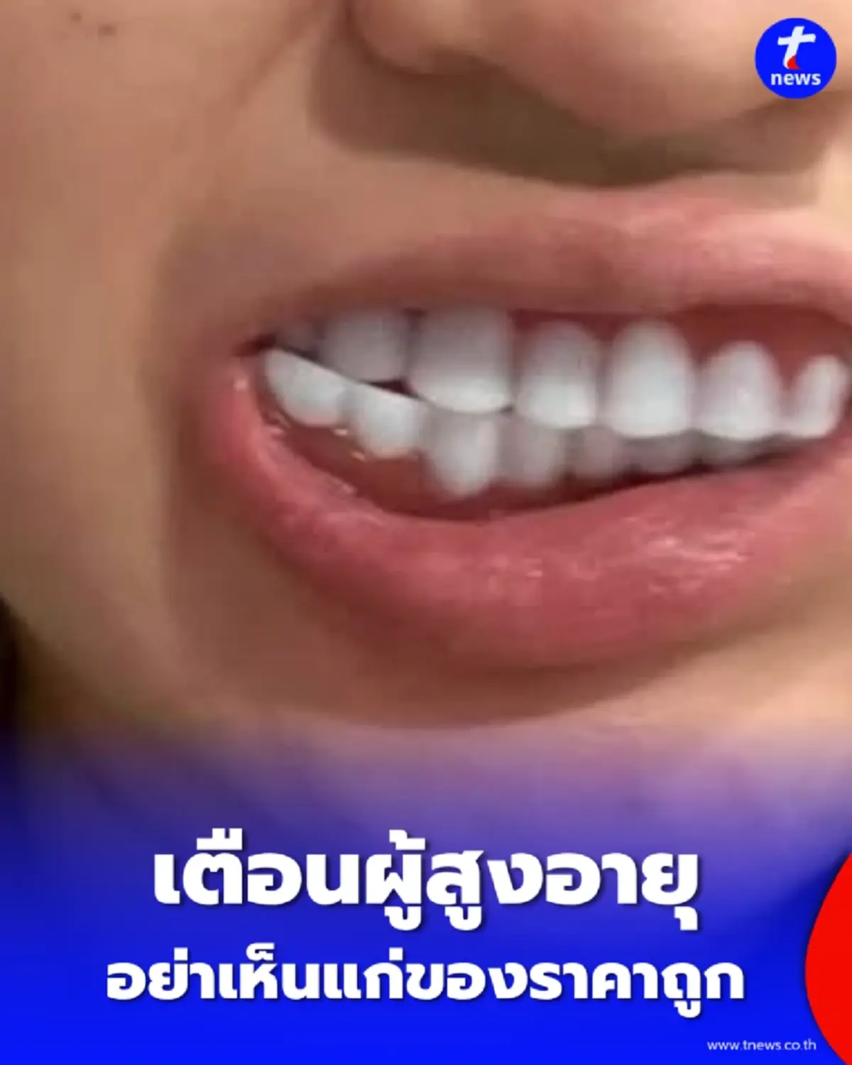เตือนภัย ฟันปลอมออนไลน์ บทเรียนราคาแพงที่ผู้สูงอายุต้องระวัง