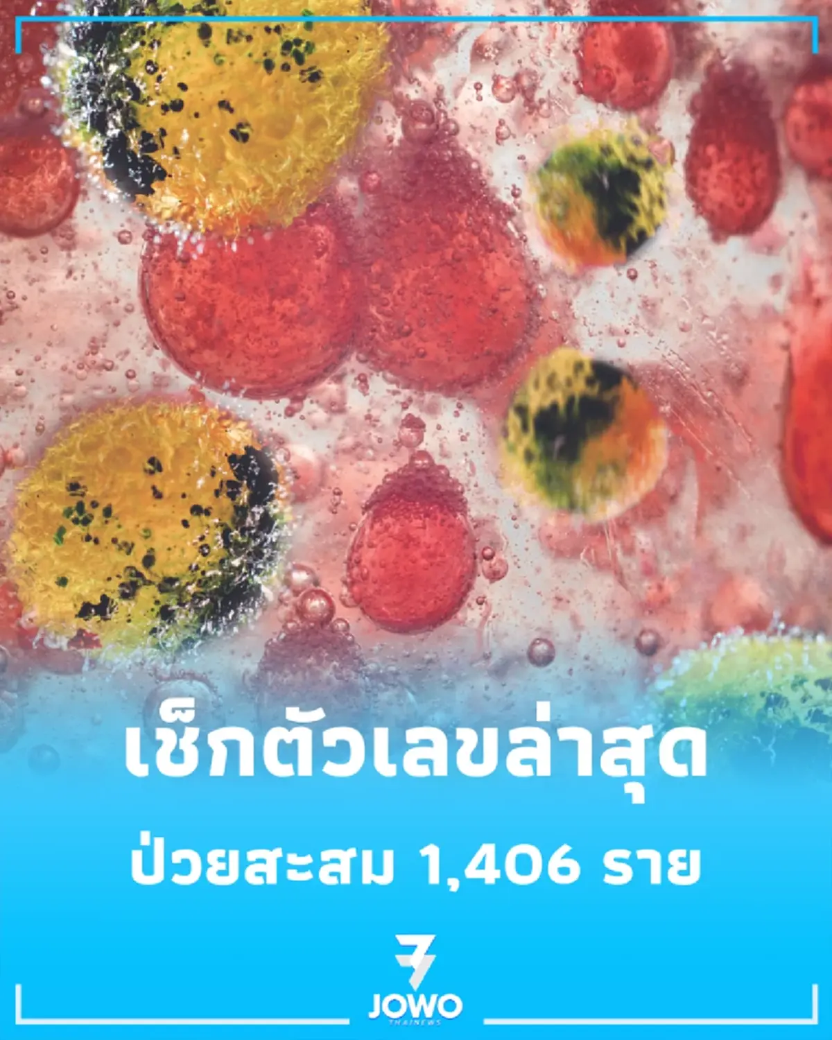ติดเชื้อทะลุ 1,406 ราย อีโบลาดีอาร์คองโกพุ่งไม่หยุด ดับแล้ว 438 ราย