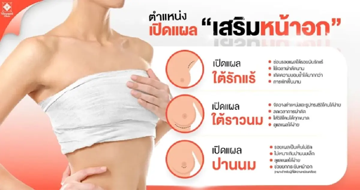 แผลเสริมหน้าอก