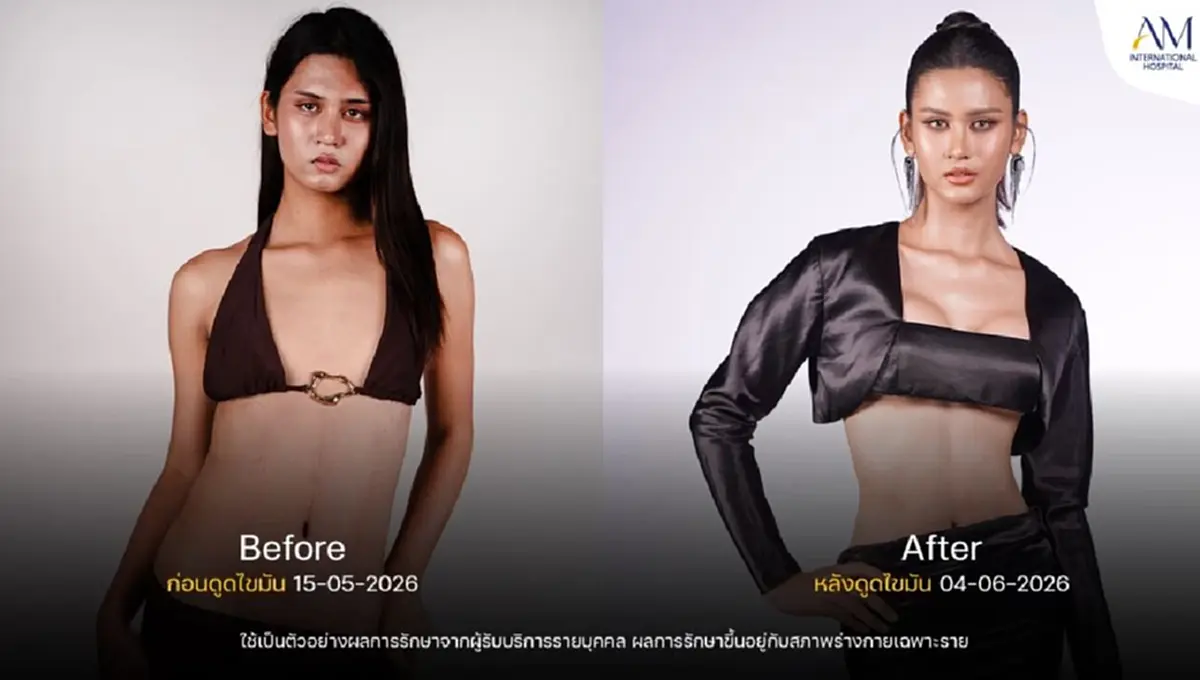 รีวิว"คุณลูกพลับ" ปรับลุคใหม่ในรายการ Surgery Wars