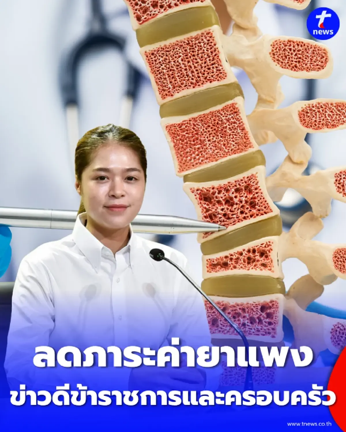 เปิดสิทธิ์ใหม่ข้าราชการ เบิกค่ายารักษากระดูกพรุนเคสเสี่ยงสูง เช็กเงื่อนไข