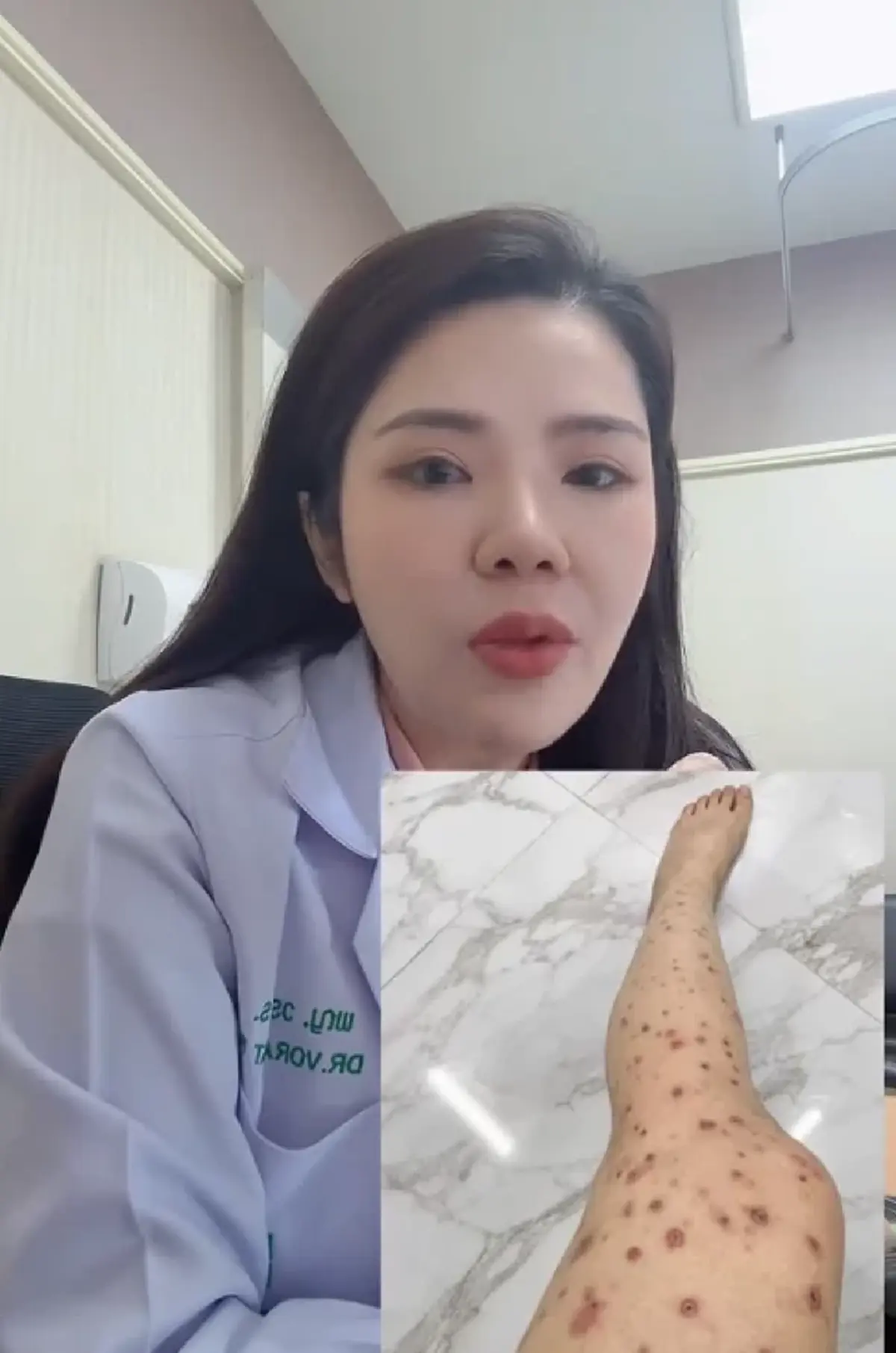 หมอเมย์ เผยสาเหตุแท้จริงสาว HIV ทำนายจ้างซวยติดวัณโรคปอดไปด้วย