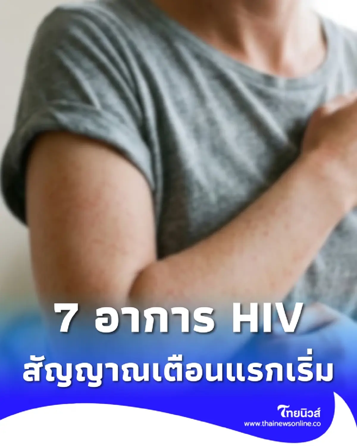 7 อาการ สัญญาณเตือนแรกเริ่มติดเชื้อ HIV ก่อนลุกลามไม่รู้ตัว