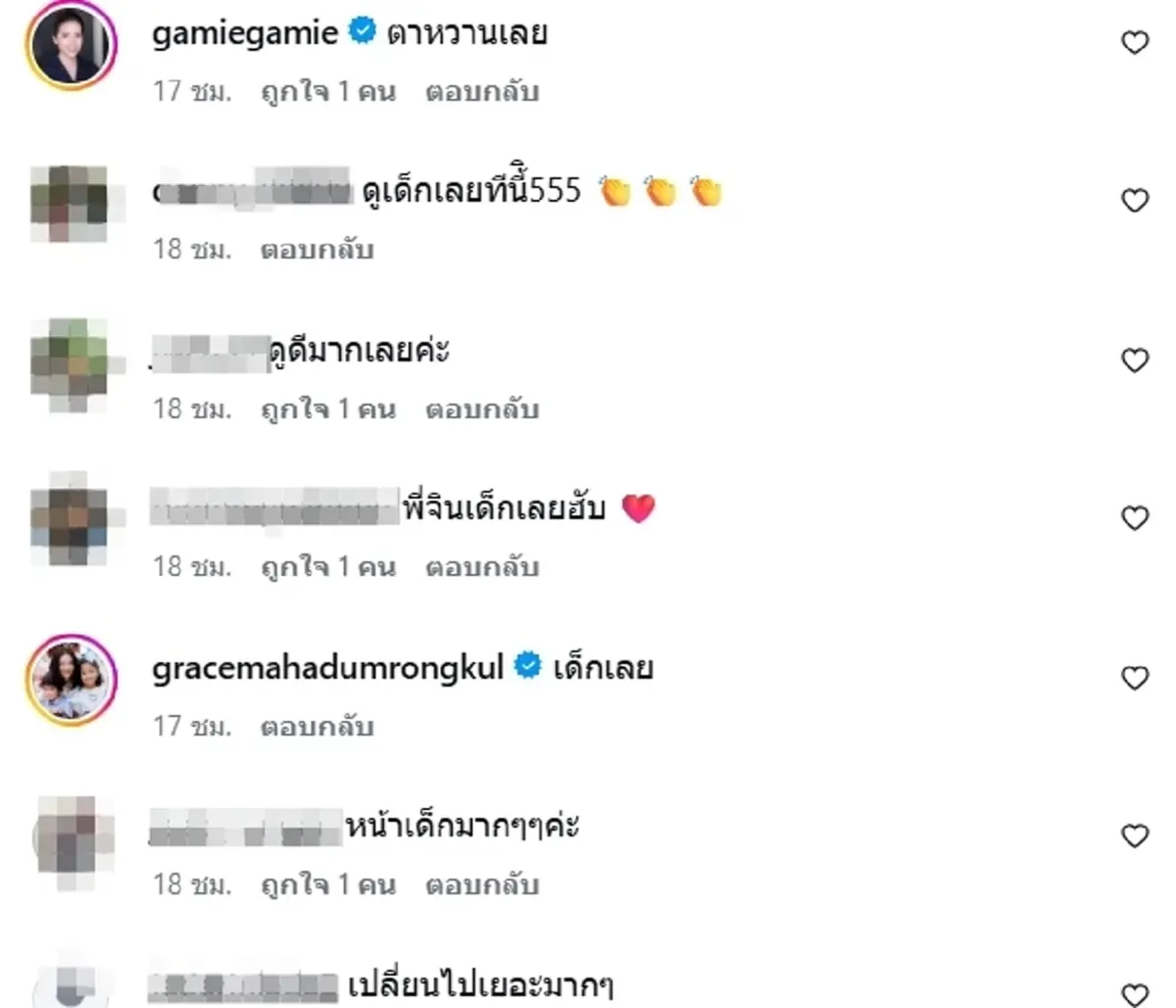 เปิดภาพล่าสุด จิน จรินทร์ หลังทำศัลยกรรมครบ 2 เดือน หน้าเด็กมาก