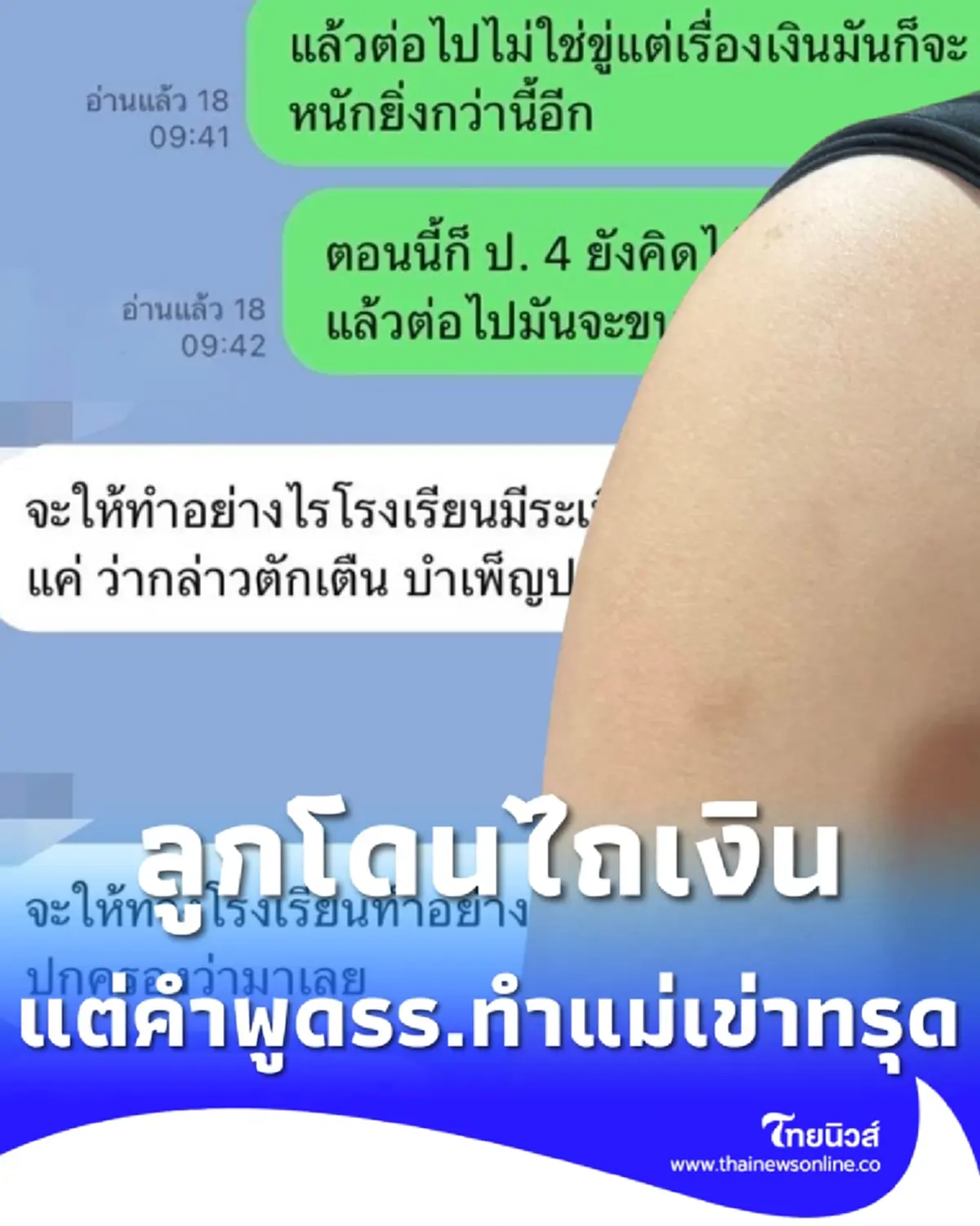 นร.ป.4 โดนเพื่อนไถเงินทุกวัน แจ้ง รร. แต่คำที่บอกมาทำแม่เข่าทรุด