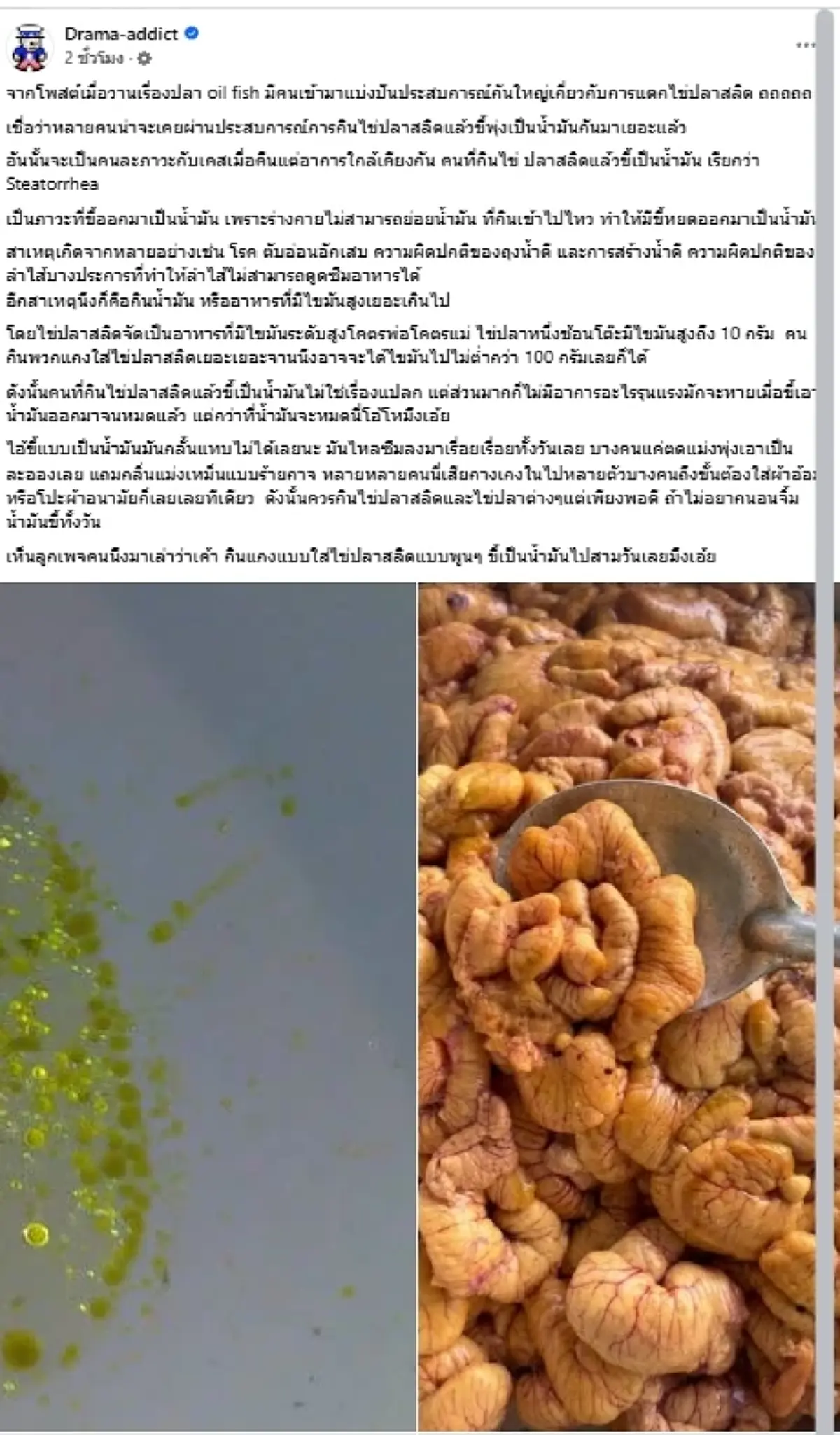 เตือนแล้วนะ ไข่ปลาสลิดกินเยอะ ระวัง "น้ำมันไหลซึม" ทั้งวัน