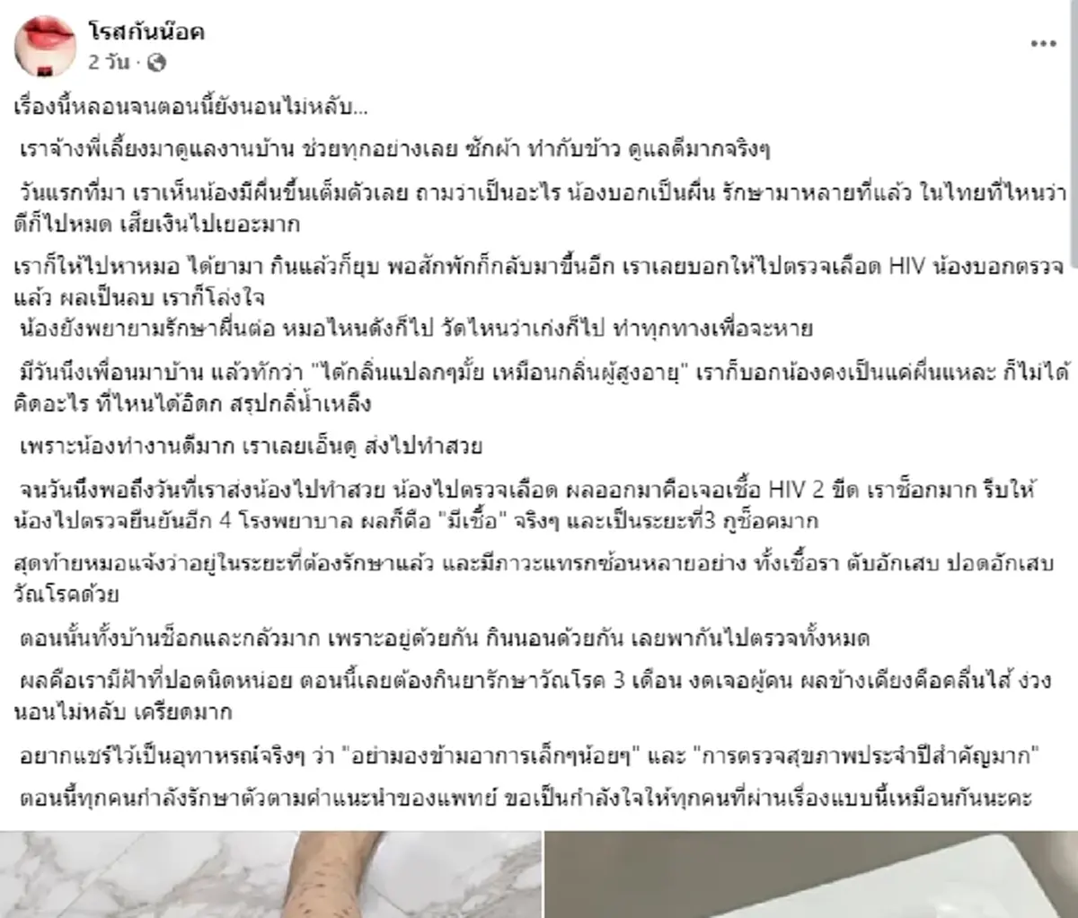 ถึงว่า พี่เลี้ยงสาวตรวจไม่เจอ HIV ทั้งๆ ที่มีผื่นเต็มตัว