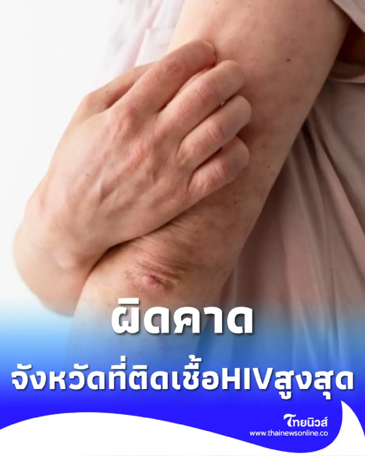 ผิดคาด เปิดจังหวัดที่มีผู้ติดเชื้อ HIV สูงที่สุดในไทย ปี 2569