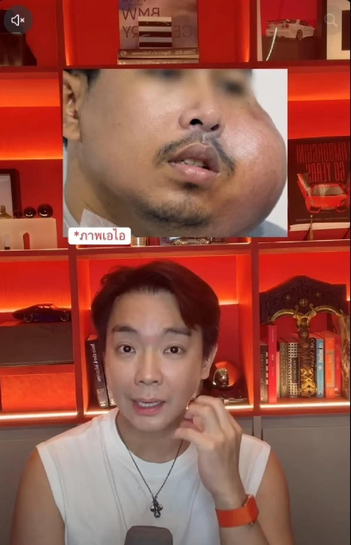 หมอพูดแล้ว ปมหนุ่ม "แคะฟัน" บวมเป็นมะเร็ง เผยชัดสาเหตุที่แท้จริง