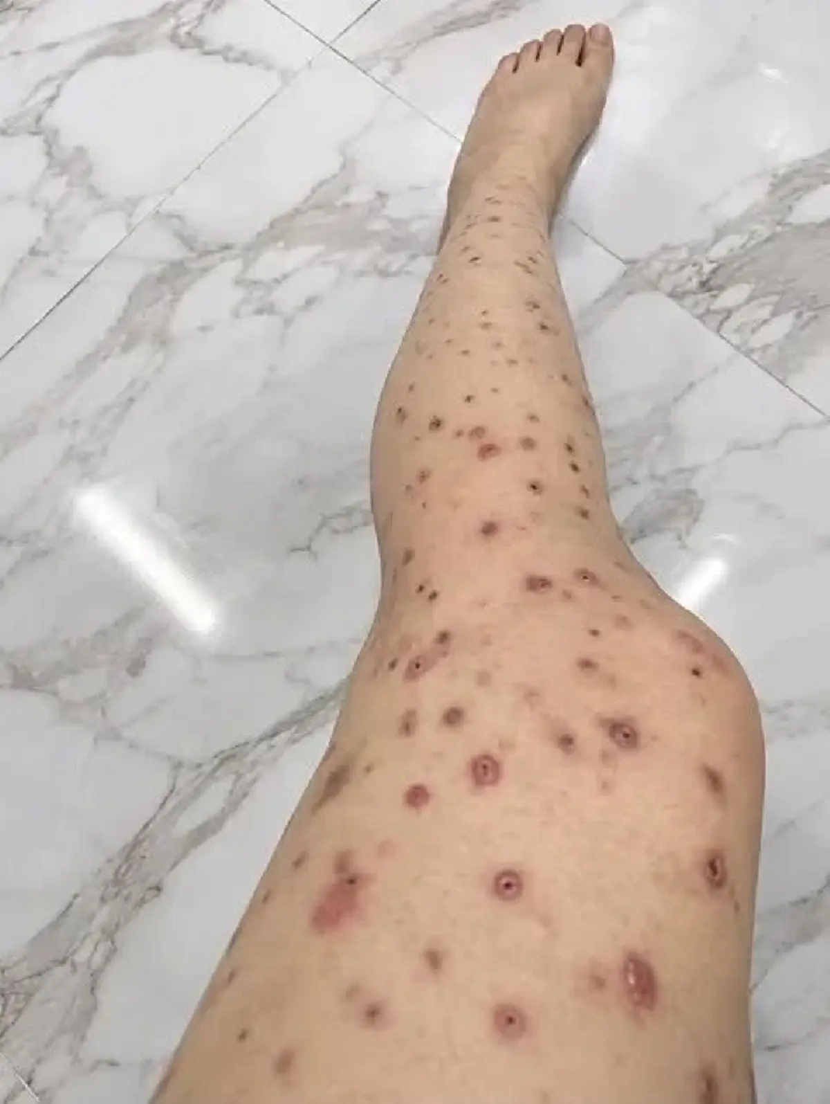 ใครเสี่ยงเช็กด่วน เปิดวิธีตรวจ HIV รู้ผลเบื้องต้นด้วยตัวเอง
