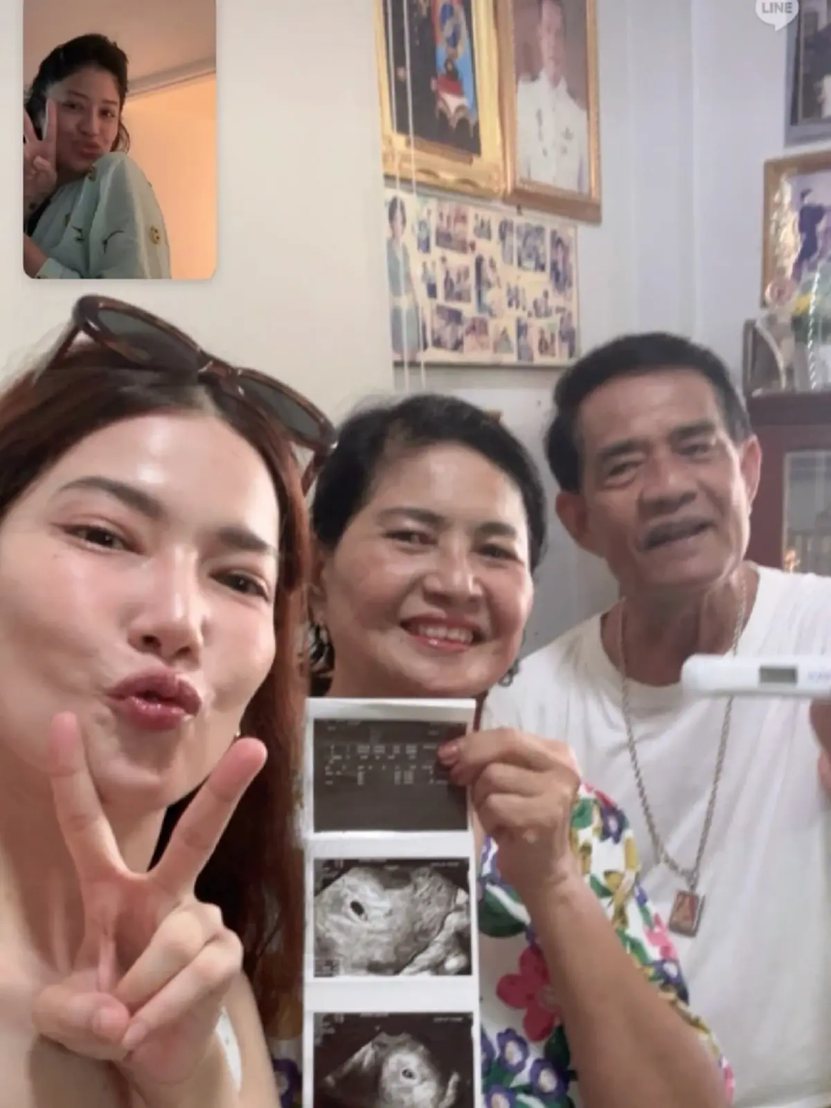 ส่งกำลังใจ นักแสดงสาว เศร้าสูญเสียลูกคนแรก ต้องยุติการตั้งครรภ์