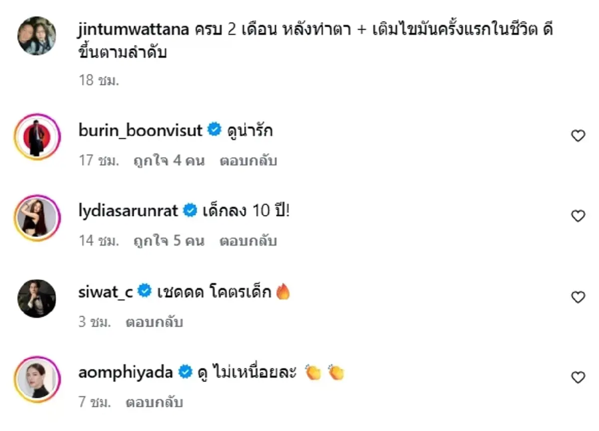 เปิดภาพล่าสุด จิน จรินทร์ หลังทำศัลยกรรมครบ 2 เดือน หน้าเด็กมาก
