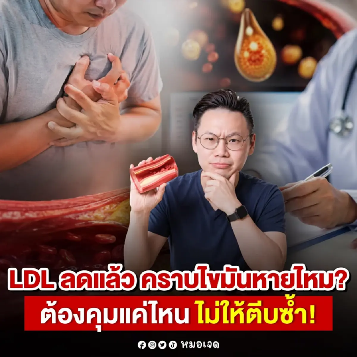 ผิดคาดหมด หมอตอบแล้ว "LDL" ลด แล้ว คราบไขมัน จะหายไปด้วยไหม 