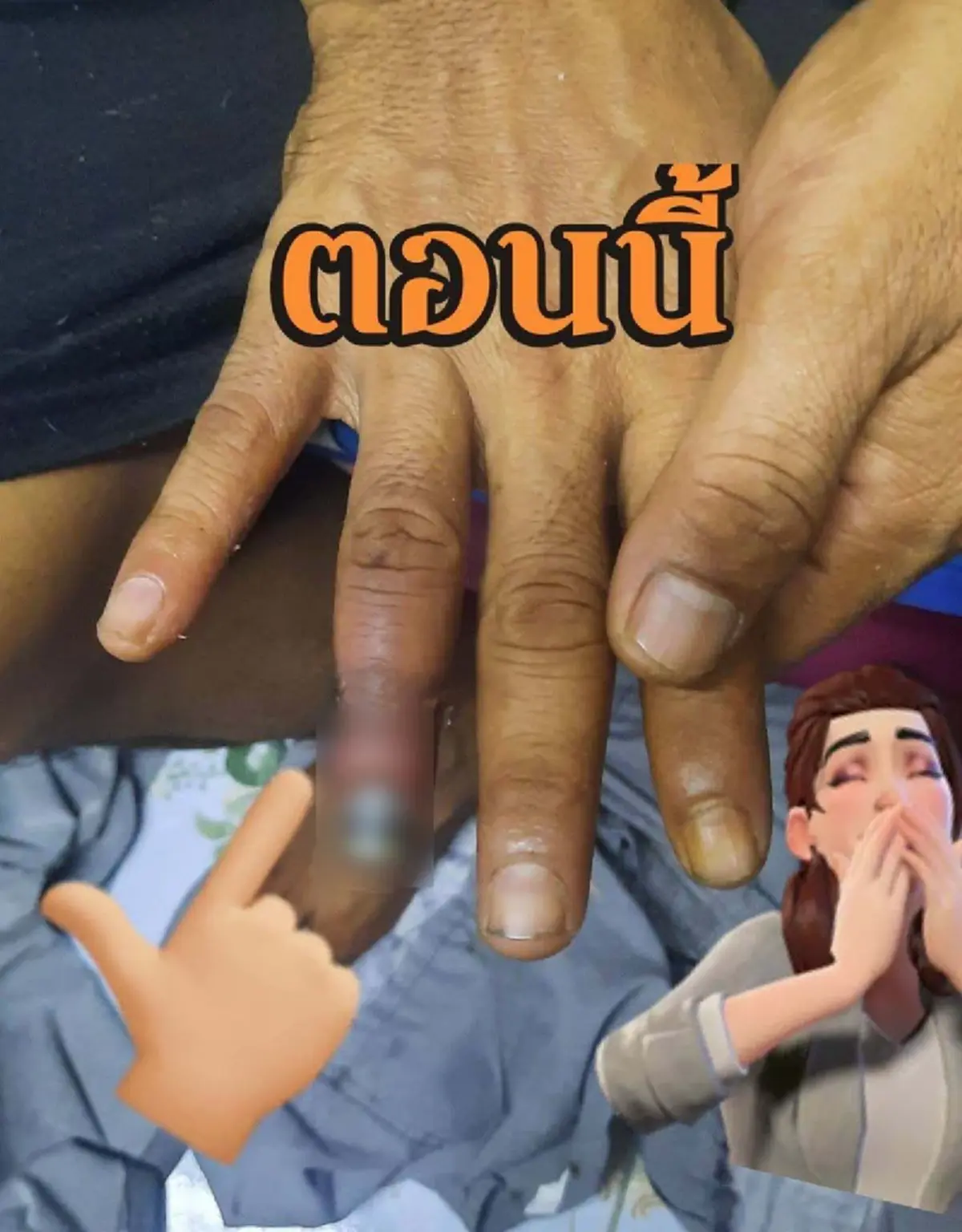 อย่าชะล่าใจ ปลายนิ้วดำ สัญญาณเตือนโรคร้าย คนสูบบุหรี่ต้องระวัง