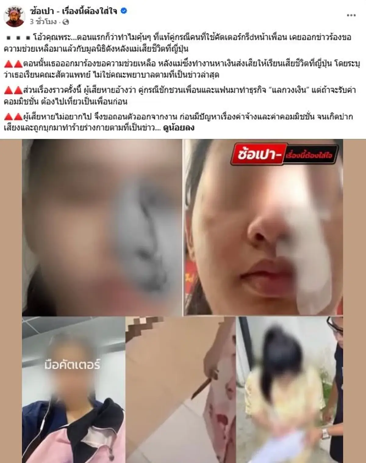 สุดพีค รู้ตัว นศ.มือคัตเตอร์ ถึงว่าคุ้นๆ ที่แท้เคยเป็นข่าวดัง