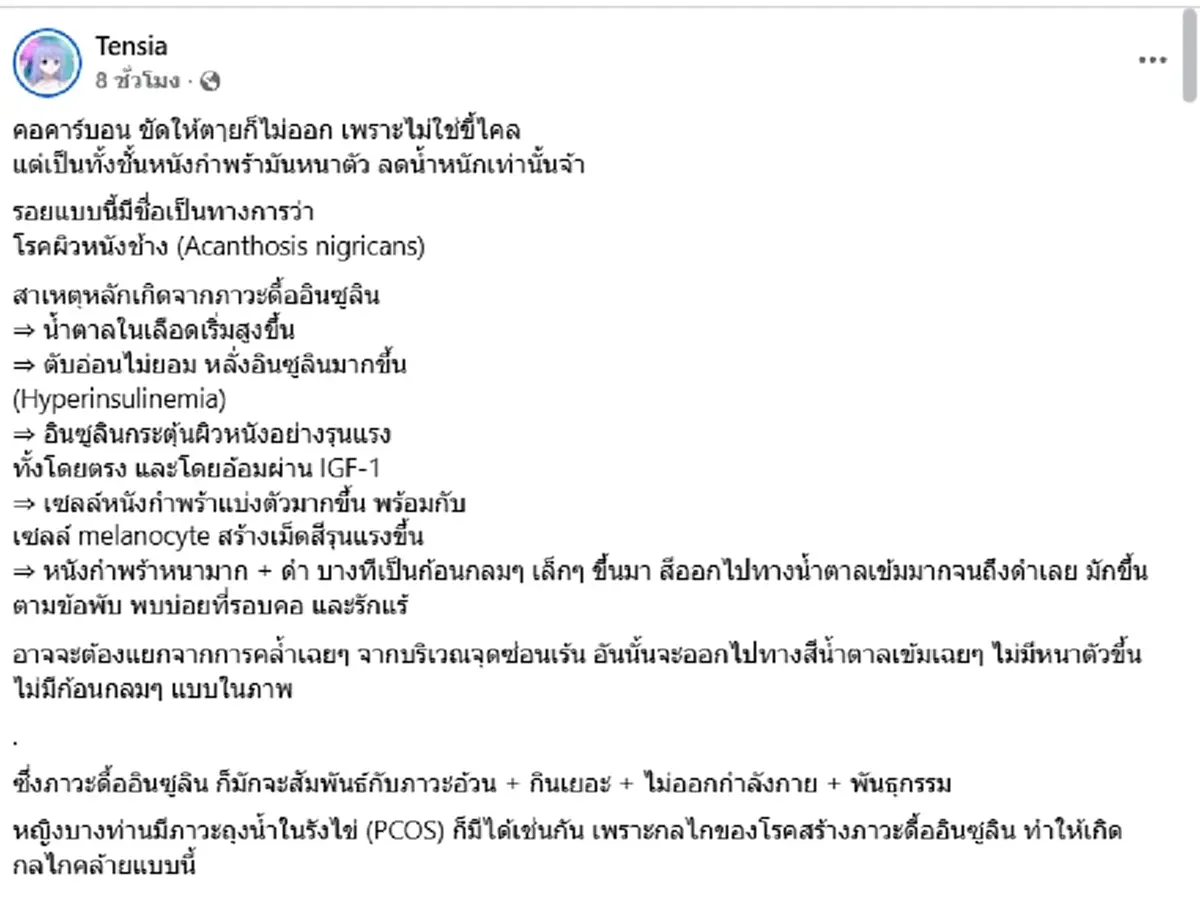 ถึงบางอ้อ "คอดำ" ขัดไม่ออก เปิดสาเหตุที่แท้จริง อาจไม่ใช่ขี้ไคล