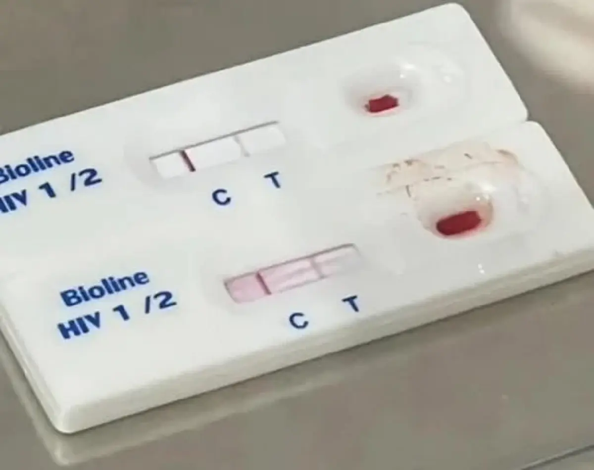 หลอนยกบ้าน อุทาหรณ์"จ้างพี่เลี้ยง" ตรวจเจอ HIV โรคแทรกซ้อนทำผวา