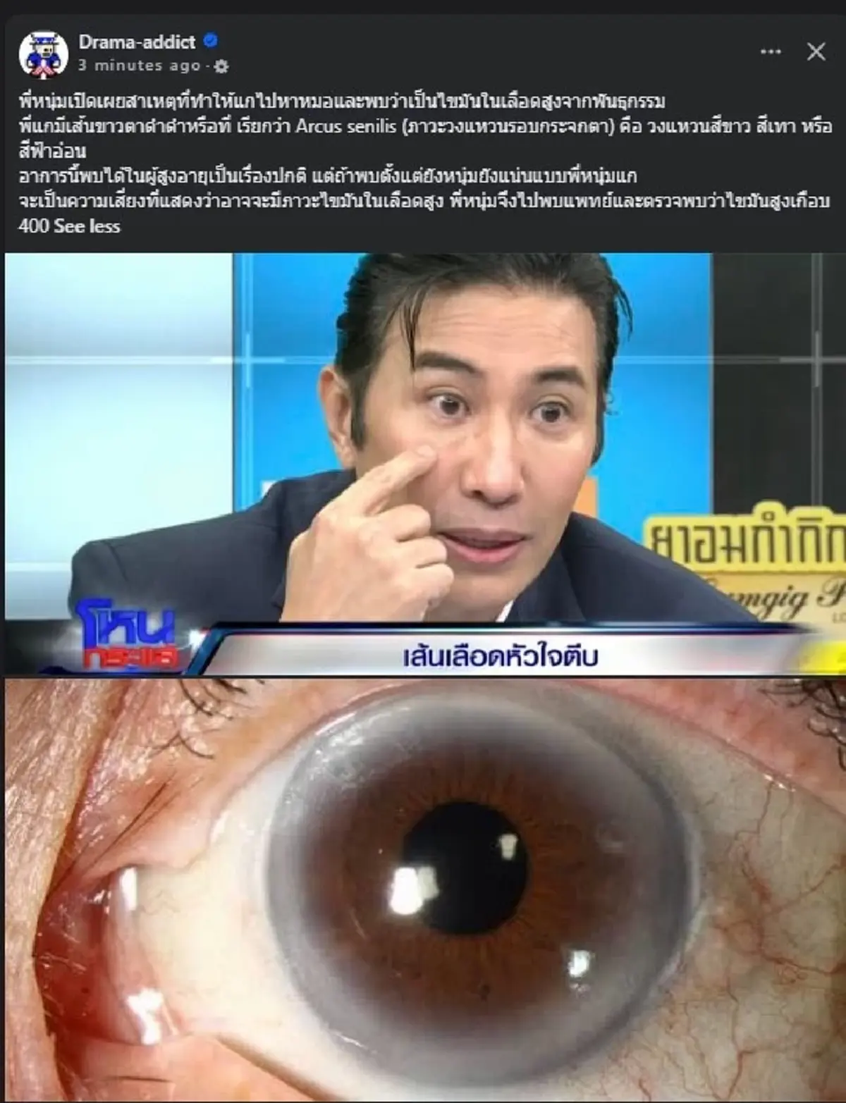 เปิดอาการที่ทำให้ "กรรชัย" ถึงขั้นไปหาหมอ ก่อนเจอไขมัน เกือบ 400