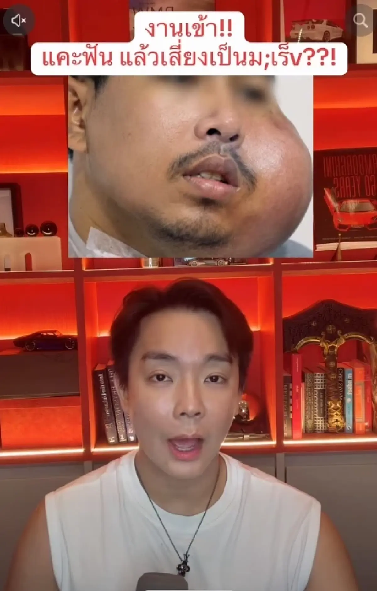 หมอพูดแล้ว ปมหนุ่ม "แคะฟัน" บวมเป็นมะเร็ง เผยชัดสาเหตุที่แท้จริง