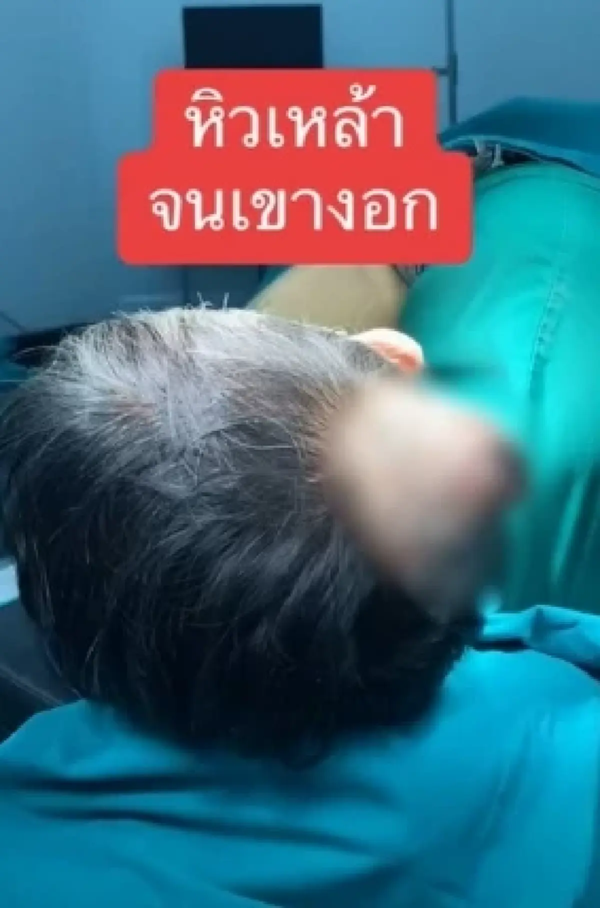 เปิดเคส "หิวเหล้า จนเขางอก" ชาย 54 ติดสุรา สุดท้ายต้องผ่าตัดด่วน