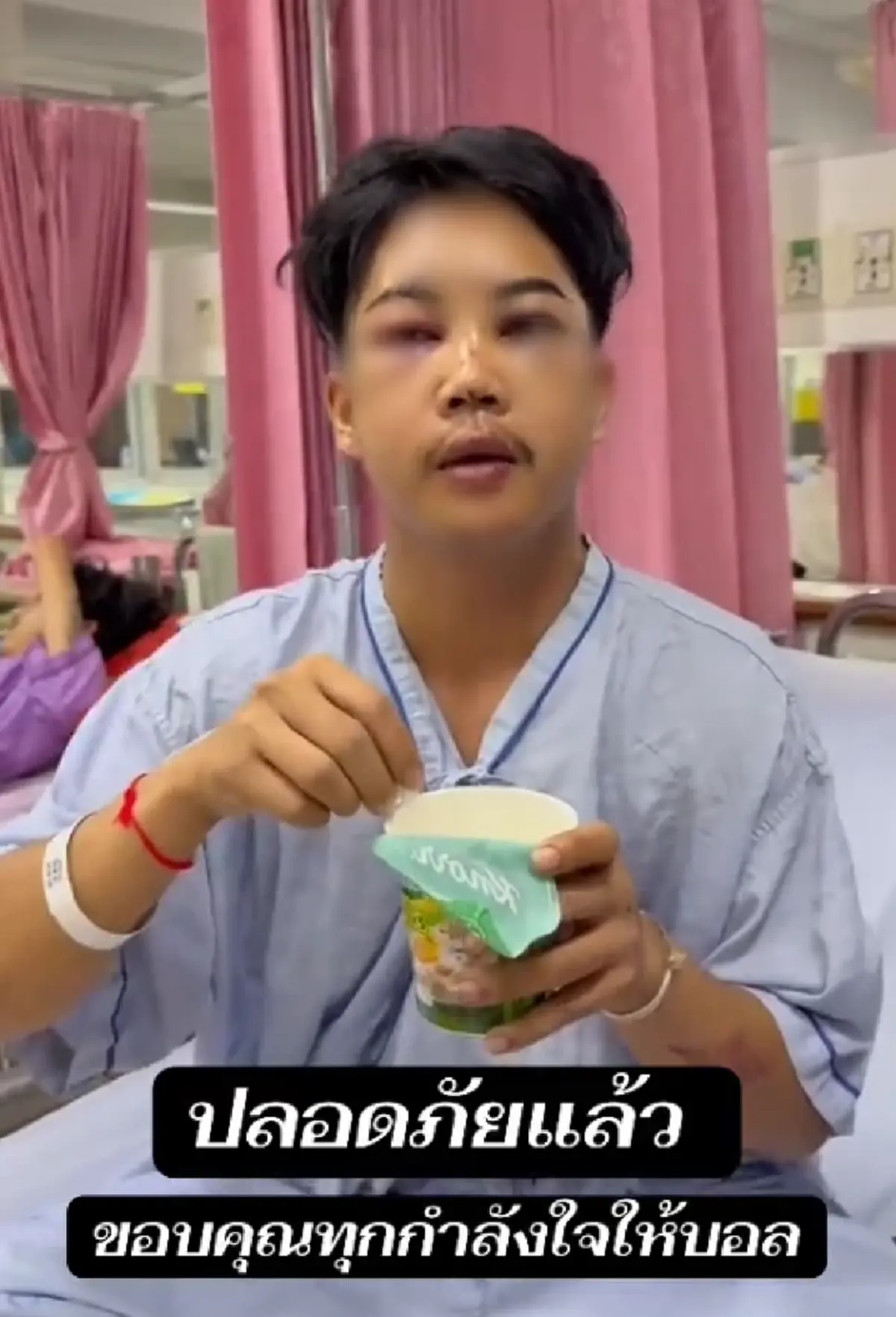 ตกใจแรง "บอล โดเรม่อน" ใบหน้าล่าสุด หลังประสบอุบัติเหตุ