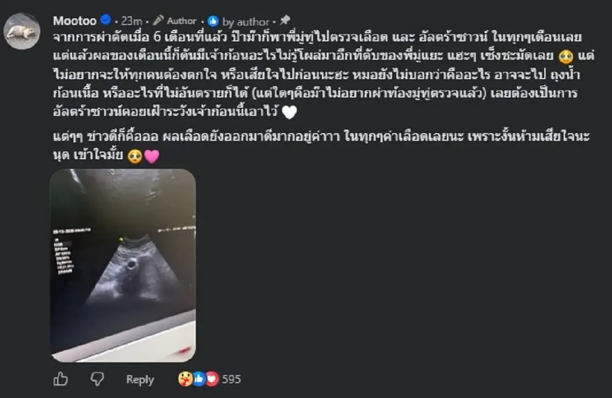 แห่ส่งกำลังใจ ให้ "มู่ทู่" หลังคุณแม่ แจ้งผลตรวจล่าสุด 