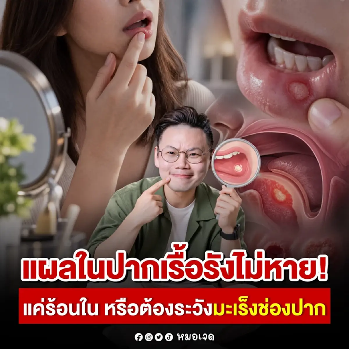 รู้แล้ว แยกยังไง "ร้อนใน" กับ "มะเร็งช่องปาก" มีแผลแบบนี้ หาหมอเลย