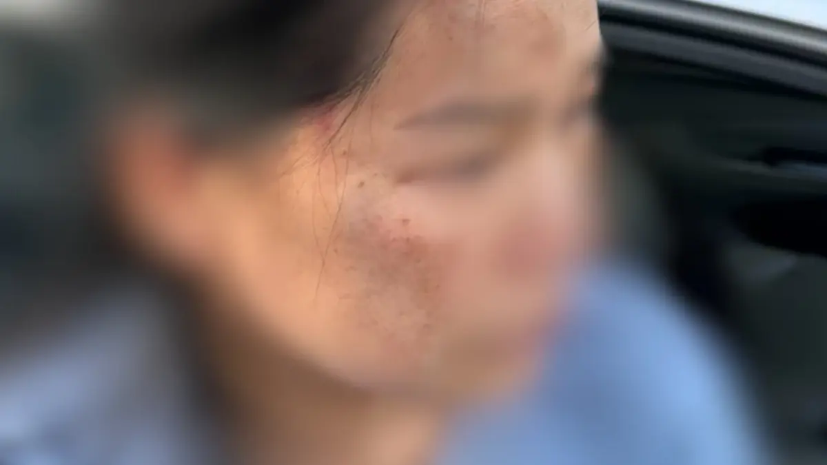 ทนายกร่าง! รัวหมัดต่อยสาวตาปิด โยนขวดน้ำปลาใส่ต่อหน้าลูก