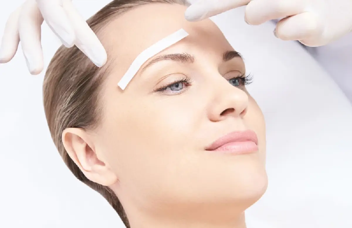 Endobrow Lift