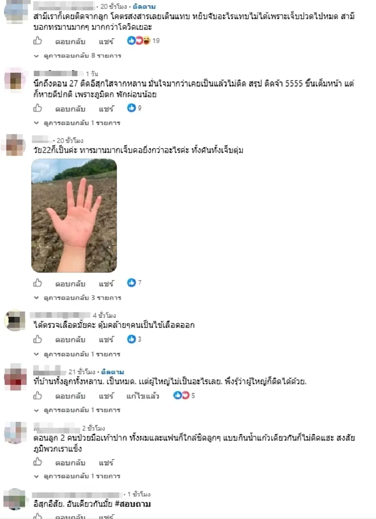 ใครจะคิด หนุ่มวัย 28 ป่วย "มือเท้าปาก" เข้าใจเลยเด็กทรมานขนาดไหน
