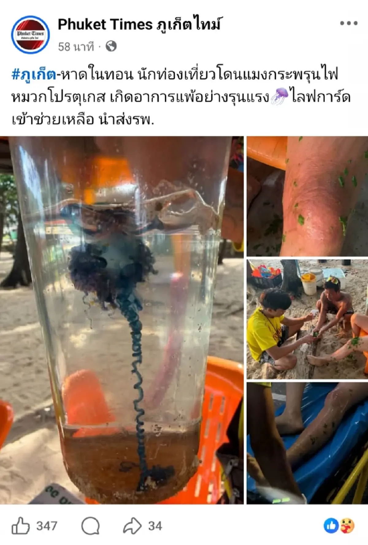 เตือนภัย! แมงกะพรุนหมวกโปรตุเกสบุกภูเก็ต ต่อยต่างชาติแพ้หนัก