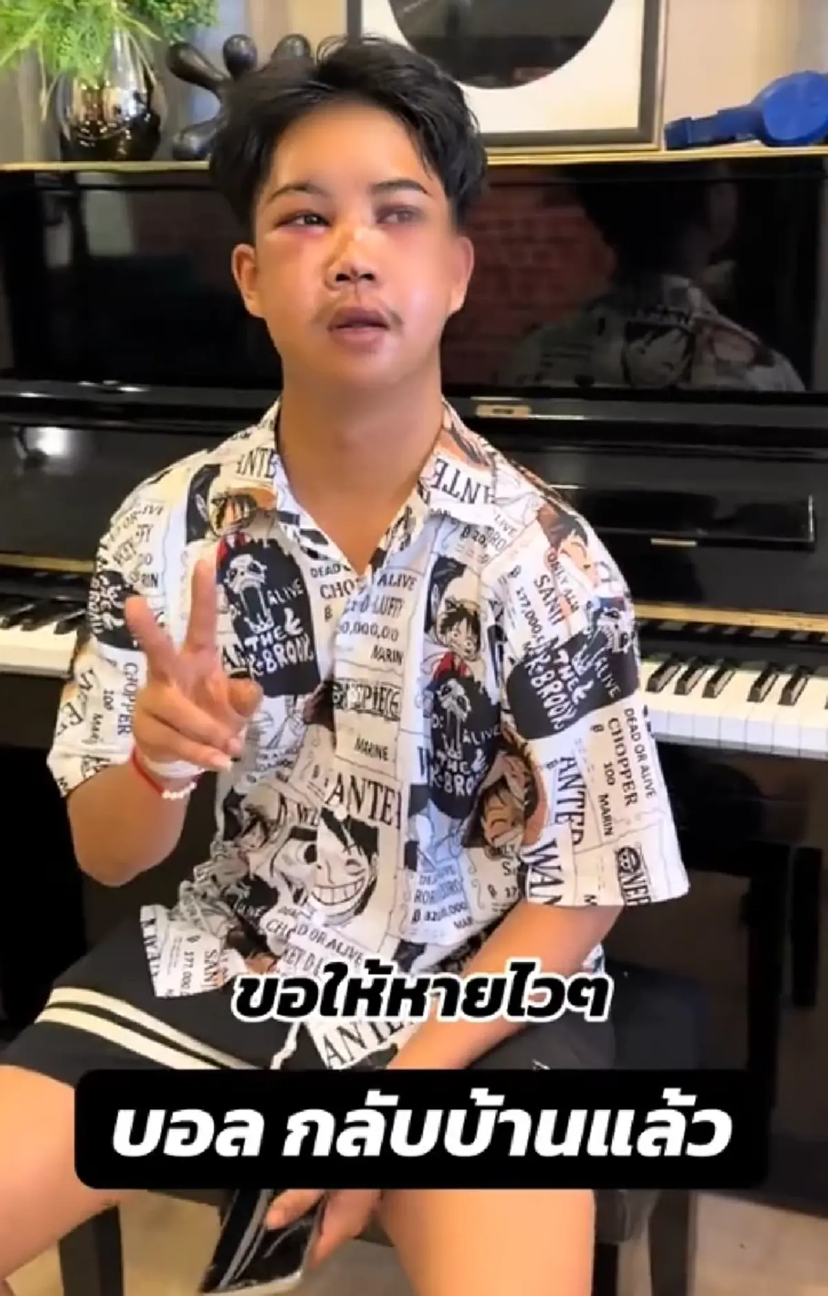 ตกใจแรง "บอล โดเรม่อน" ใบหน้าล่าสุด หลังประสบอุบัติเหตุ