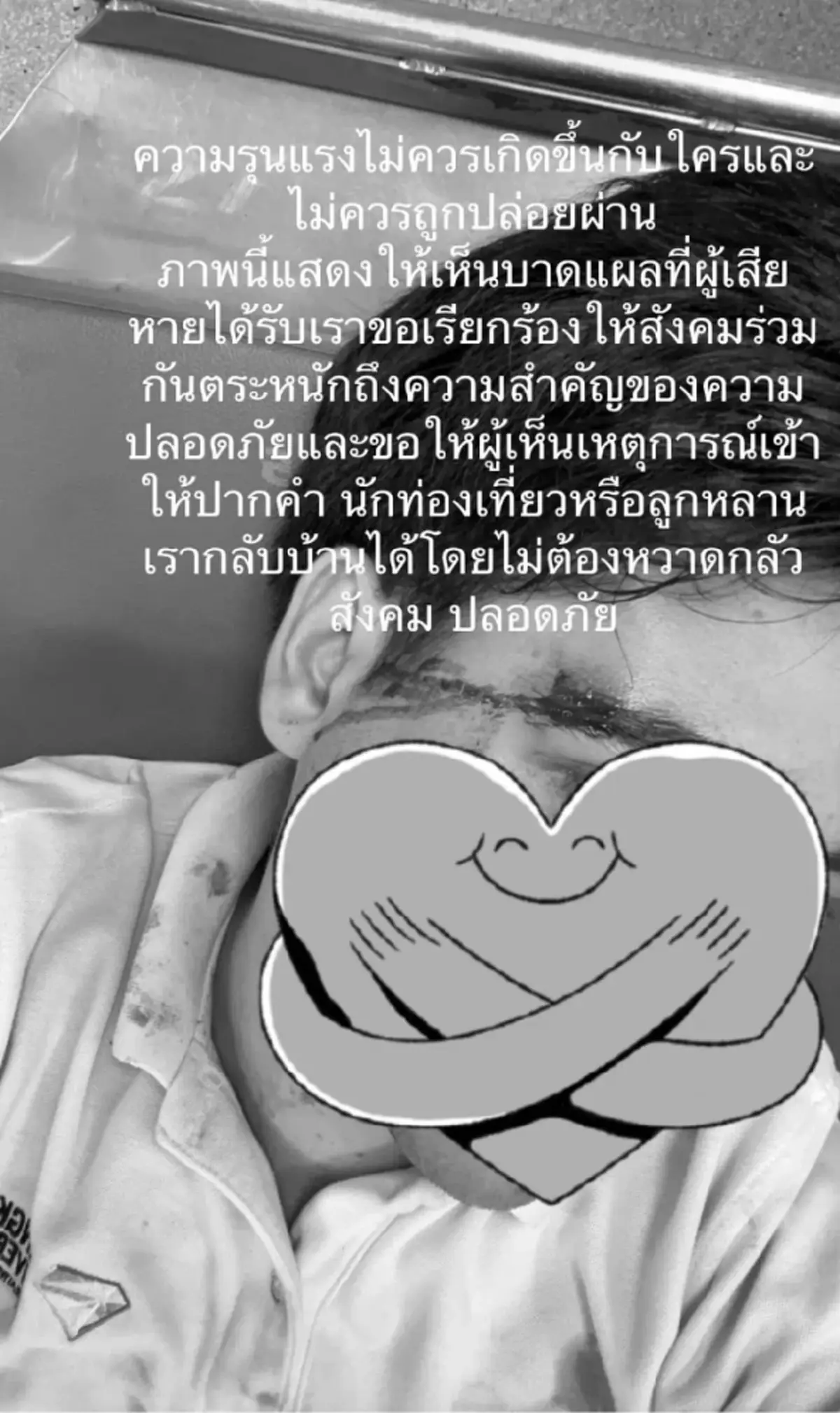 อดีตดาราเด็ก ร้องสื่อทั้งน้ำตา! น้องชายถูกวัยรุ่นรุมทำร้าย  