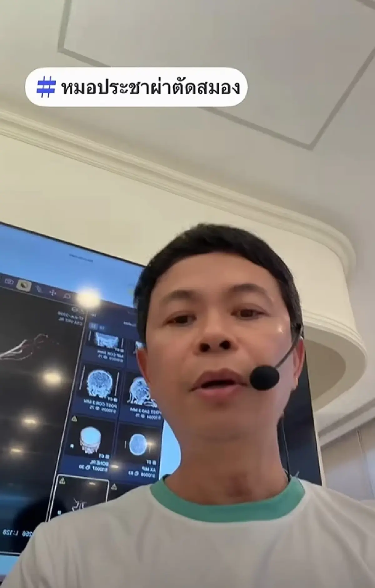 อาการนึกชื่อคน-ชื่อของไม่ออก อย่ามองข้าม ปล่อยไว้สมองอาจตายได้
