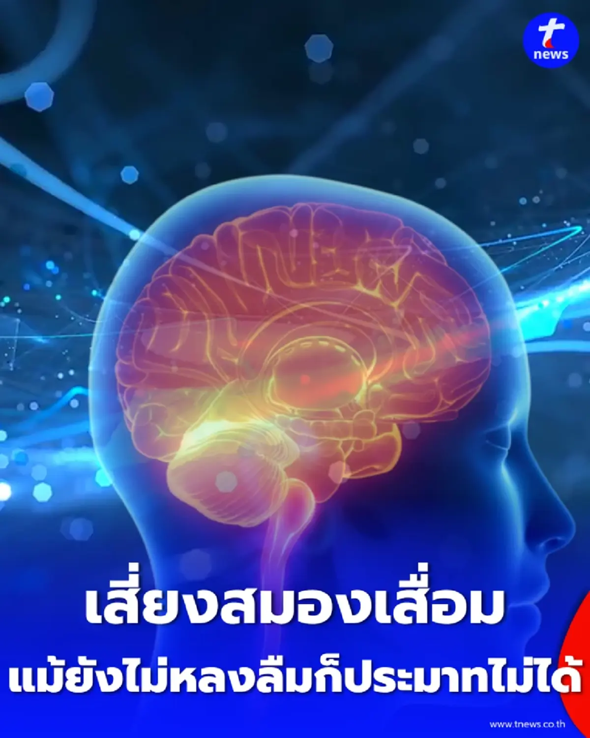 สมองเสื่อมไม่ได้มีแค่อาการขี้ลืม เปิดพฤติกรรมเสี่ยงที่หลายคนมองข้าม